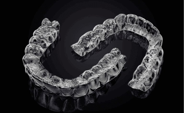 Aligners at Dental Sense
