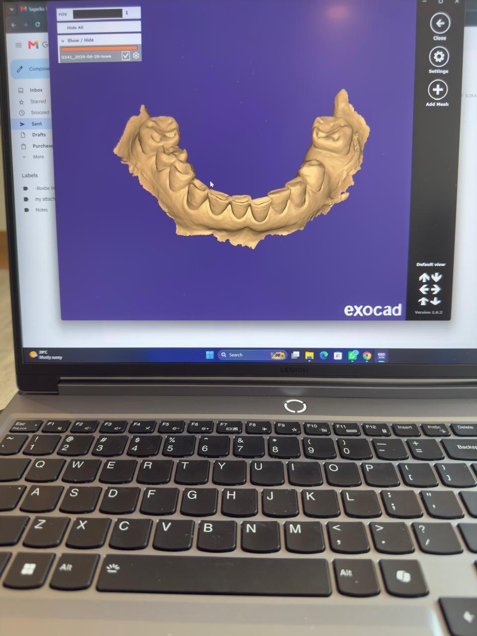 Lower jaw CAD scan for digital dentistry planning.