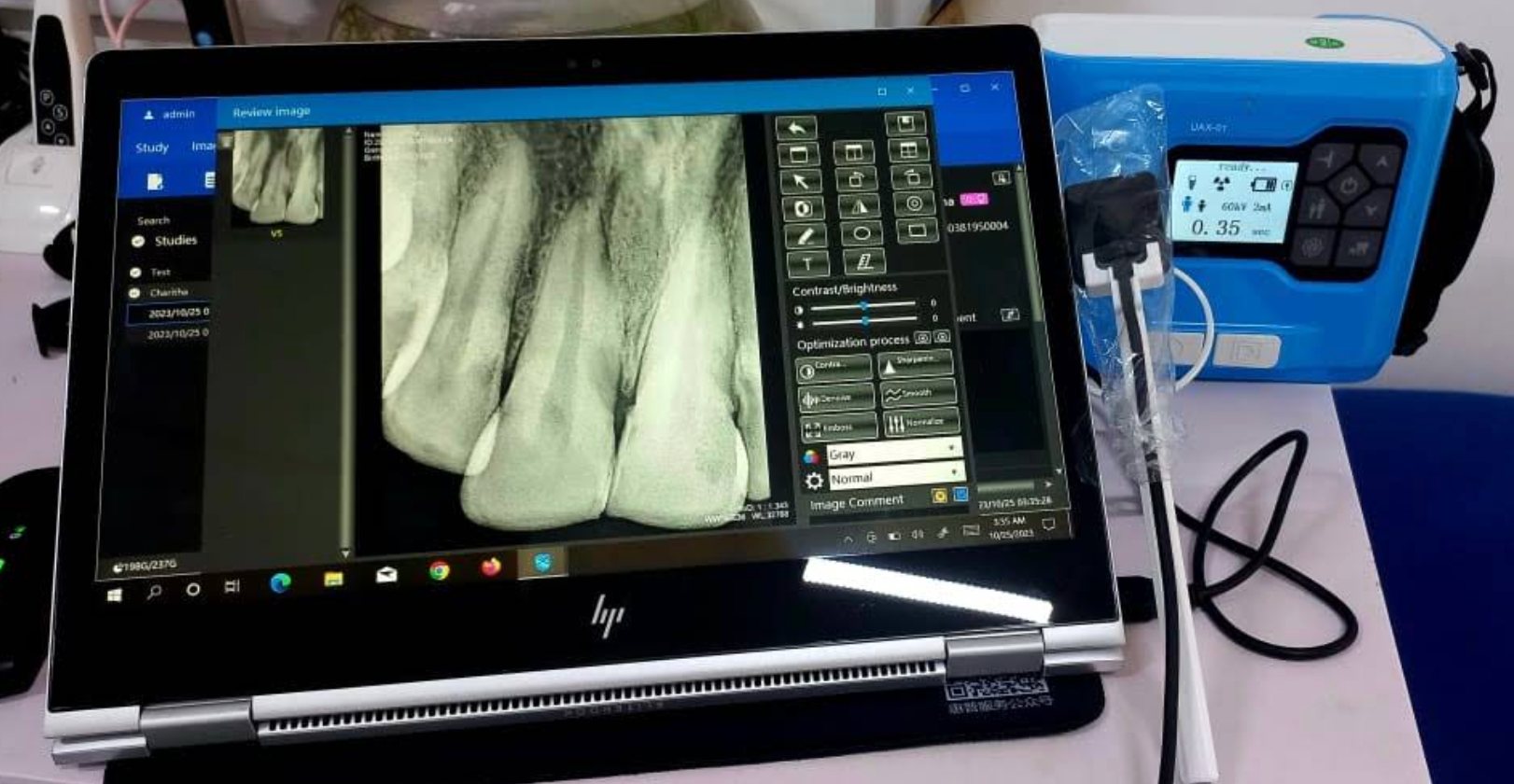Digital dental x-ray review