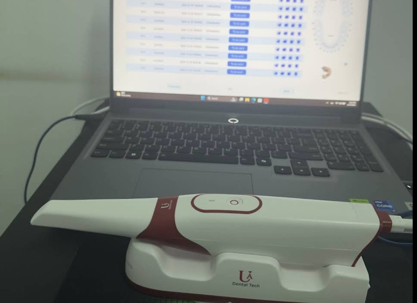 Intraoral scanner at Dental Sense