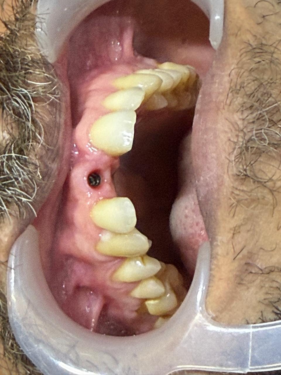 Implant treatment clinical view.